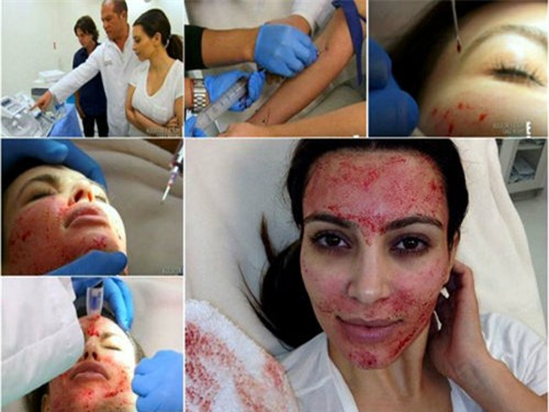 làm đẹp, dát vàng, nữ đại gia