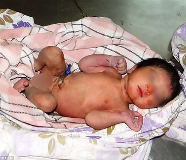 Bé gái sơ sinh bị bỏ rơi trong bụi rậm, gai nhọn đâm khắp người - Ảnh 2.