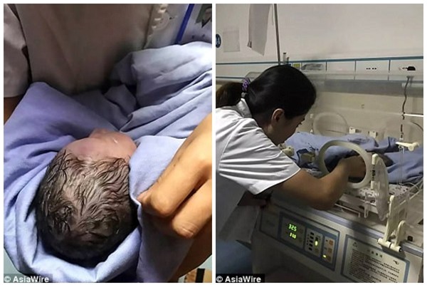 suc song ky dieu cua be gai so sinh bi me 12 tuoi bo roi trong bui cay nhieu gio lien - 2