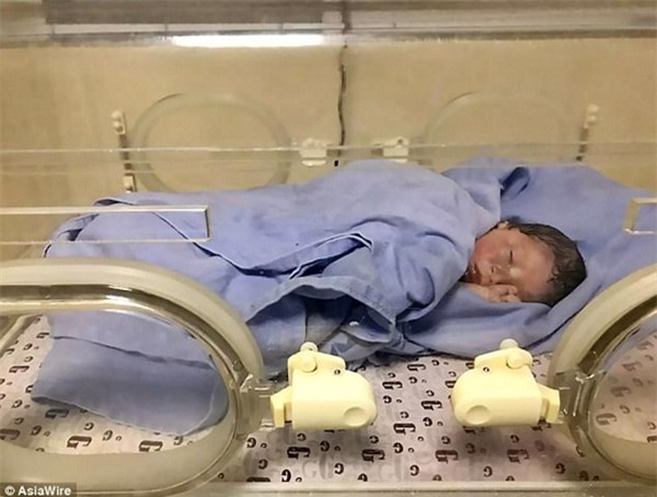 suc song ky dieu cua be gai so sinh bi me 12 tuoi bo roi trong bui cay nhieu gio lien - 3