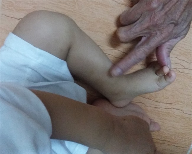 Cuộc sống mới của bé trai 1 tuổi bị bạo hành thập tử nhất sinh tại ngôi nhà ông bà ngoại - Ảnh 2.