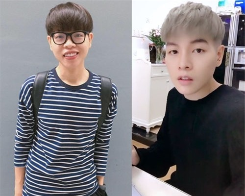 Đức Phúc trước và sau phẫu thuật thẩm mỹ. - Tin sao Viet - Tin tuc sao Viet - Scandal sao Viet - Tin tuc cua Sao - Tin cua Sao