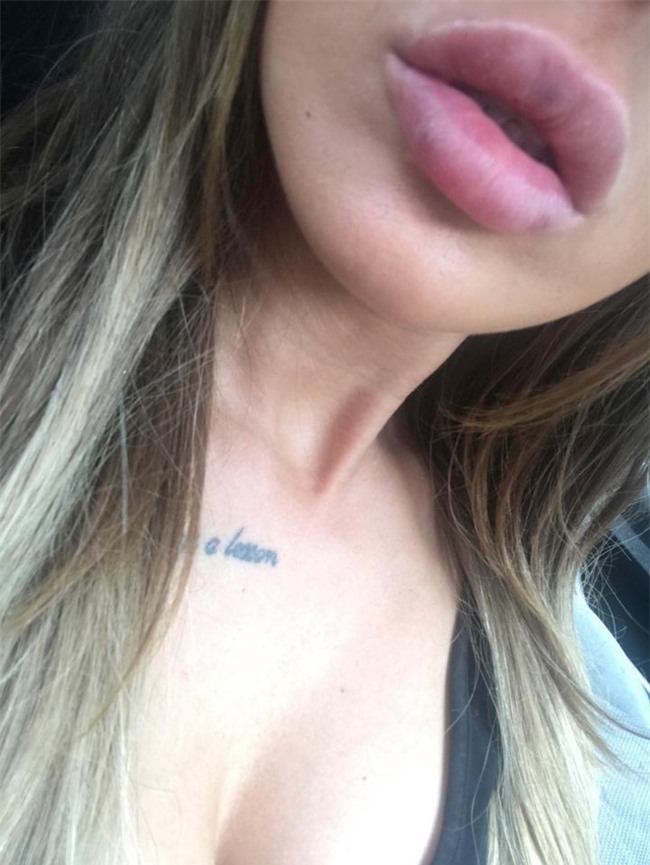 Bơm môi giá bèo vì nghe quảng cáo Facebook: Chậm 1 phút vô phương cứu chữa! - Ảnh 3.