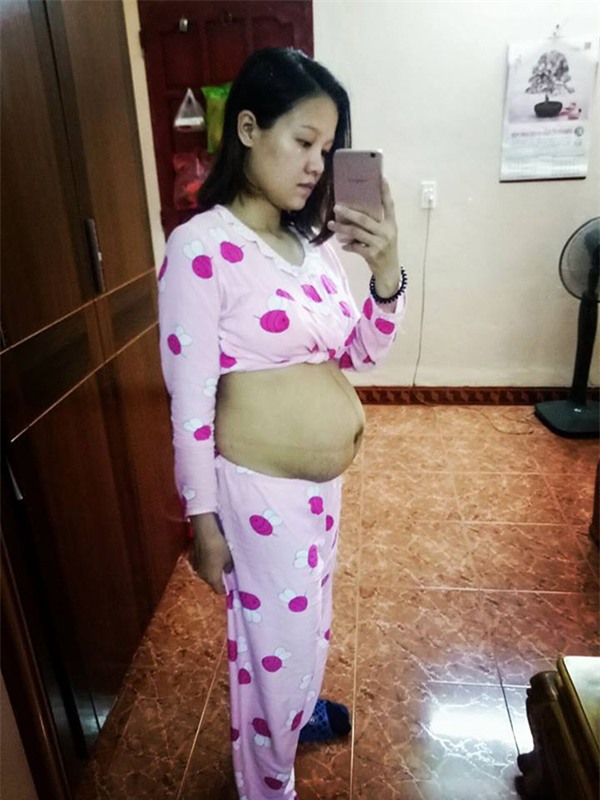 vong eo 10 ngay sau sinh “nhu chua de" cua me 9x khien hoi chi em con son giat minh - 1