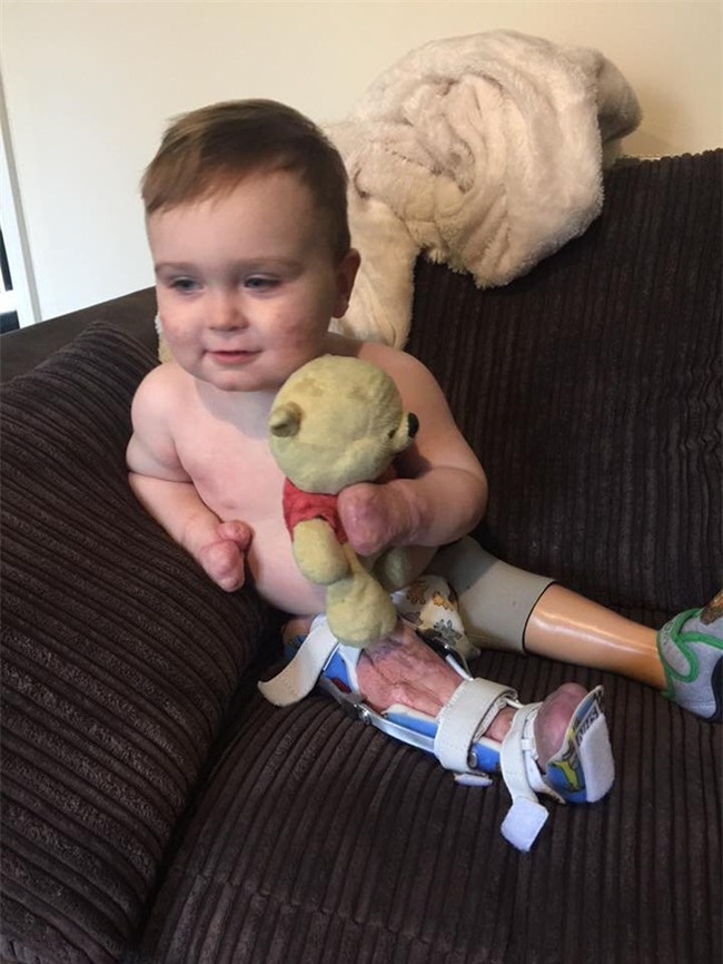 Viêm màng não đã khiến bé trai này chịu thương tổn thế nào, các cha mẹ cần biết - Ảnh 9.