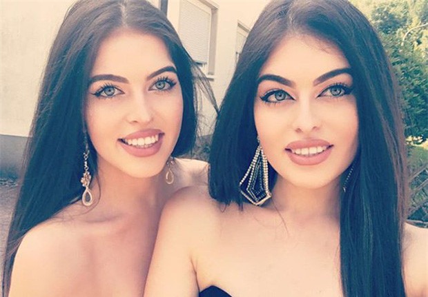 Chi em song sinh mat xinh, dang chuan noi tieng tren mang xa hoi hinh anh 2