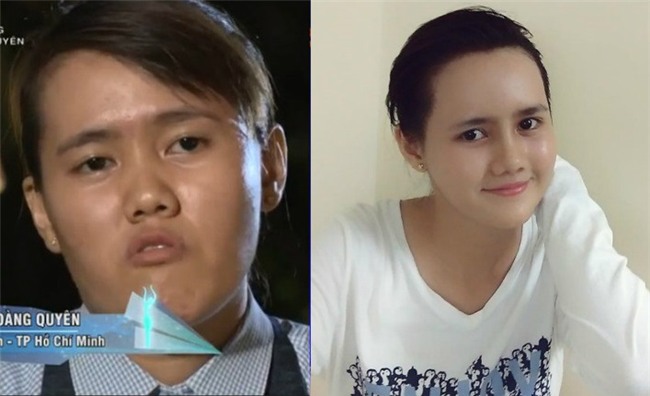 Mất tích 1 năm, cô gái 24 tuổi bị chê mặt lưỡi liềm trở về khiến mẹ nhận không ra-1