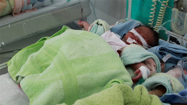 Be gai sinh non bi bo roi trong tui nylon hinh anh 1