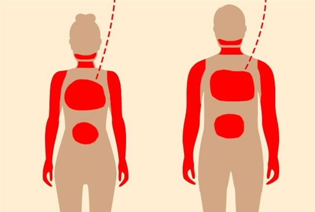 1 tháng trước khi cơn đau tim, cơ thể bạn sẽ cảnh báo với 7 tín hiệu này - Ảnh 9.