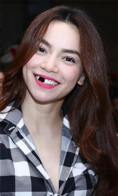 Trai xinh, gái đẹp showbiz Việt sẽ ra sao nếu một ngày bất ngờ… sún răng! - Ảnh 1.