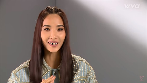 Trai xinh, gái đẹp showbiz Việt sẽ ra sao nếu một ngày bất ngờ… sún răng! - Ảnh 14.