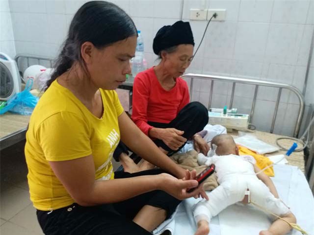 con gai 16 thang tuoi bi bong, me boi kem danh rang lam mat nhan cai ket dau long - 2