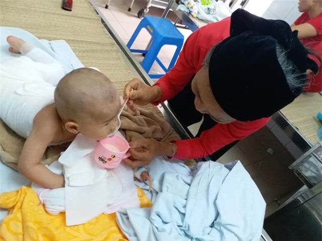 con gai 16 thang tuoi bi bong, me boi kem danh rang lam mat nhan cai ket dau long - 3