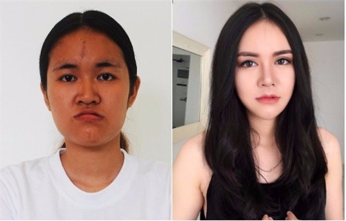 Cô gái trẻ lột xác sau màn phẫu thuật thẩm mỹ quá xuất sắc và câu chuyện cay đắng phía sau - Ảnh 2.