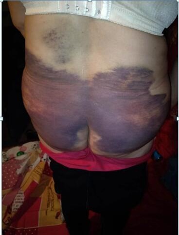 Người phụ nữ bị chồng bạo hành suốt 20 năm, biến thành nô lệ phục vụ cho nhân tình của chồng - Ảnh 2.