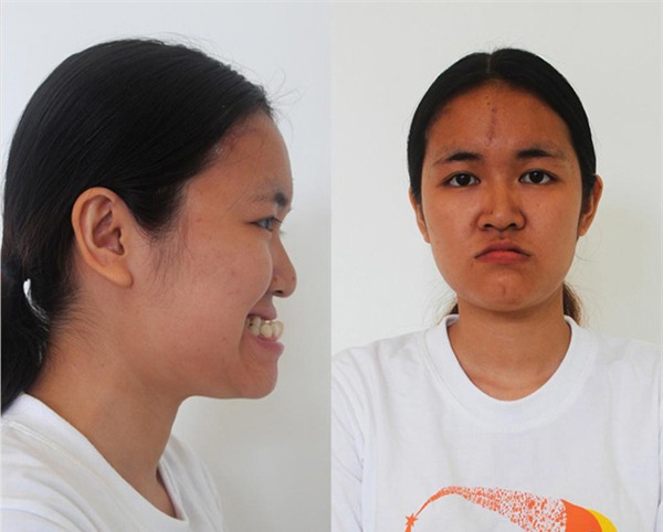 Từng bị gọi vượn chưa tiến hóa, cô gái xứ Thanh lột xác ấn tượng-1