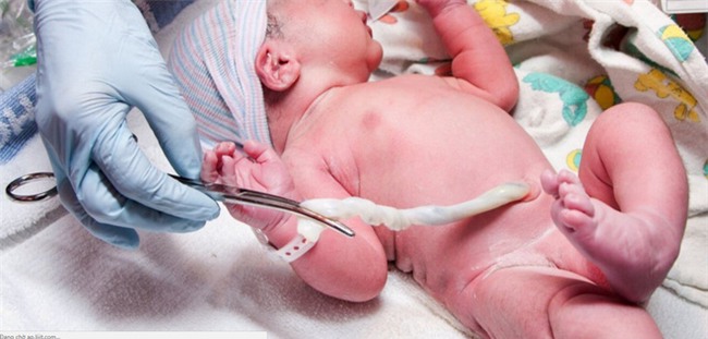 Giải mã hiện tượng dây rốn quấn cổ thai nhi khiến nhiều mẹ bầu lo lắng - Ảnh 1.