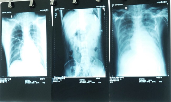 Vừa hết nghỉ thai sản, vợ nghẹn ngào khi con đau, chồng bất ngờ gặp bạo bệnh trên đường đi làm - Ảnh 5.