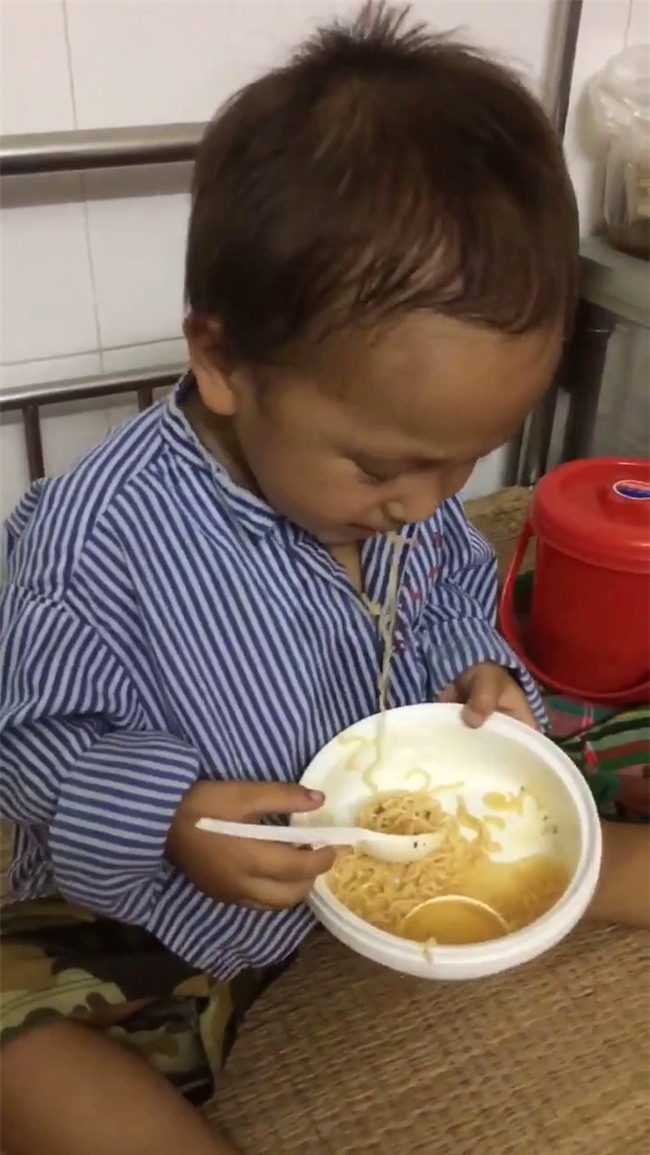 Nhói lòng hình ảnh cậu bé 3 tuổi người Mông vừa bị lũ cuốn mất nhà lại có nguy cơ mù mắt - Ảnh 2.