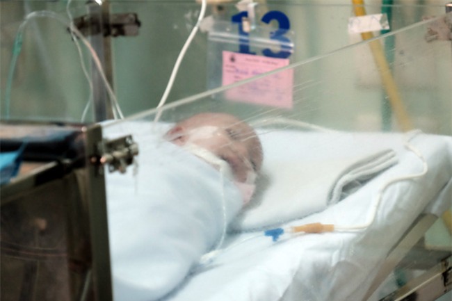 Bé gái mang khối u quái dị trông như có 2 đầu bị mẹ bỏ rơi khi đưa đến bệnh viện một ngày - Ảnh 7.