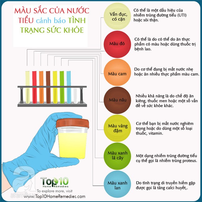 Màu sắc của nước tiểu cảnh báo tình trạng sức khỏe của bạn - Ảnh 1.