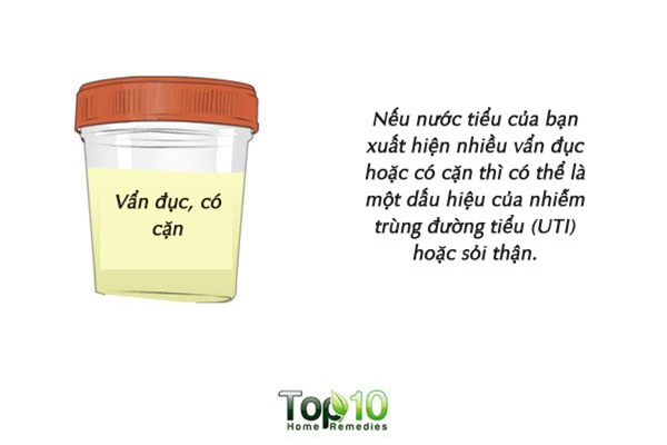Màu sắc của nước tiểu cảnh báo tình trạng sức khỏe của bạn - Ảnh 2.