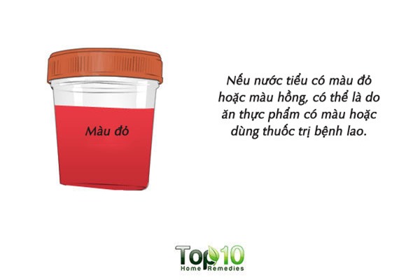 Màu sắc của nước tiểu cảnh báo tình trạng sức khỏe của bạn - Ảnh 3.