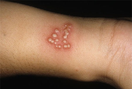 Bệnh một đằng, dùng thuốc một nẻo - Ảnh 2.