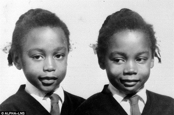 cau chuyen ki la ve mot cap song sinh vua yeu thuong vua muon giet lan nhau - 2