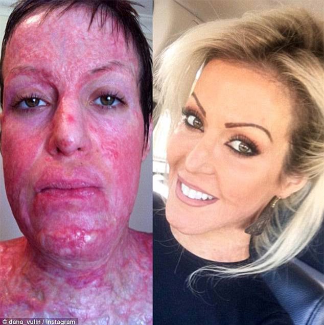 loi ke hai hung cua co gai bi nguoi la thieu song nhu ngon duoc vi... danh ghen nham - 1