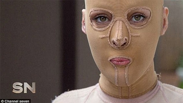 loi ke hai hung cua co gai bi nguoi la thieu song nhu ngon duoc vi... danh ghen nham - 3