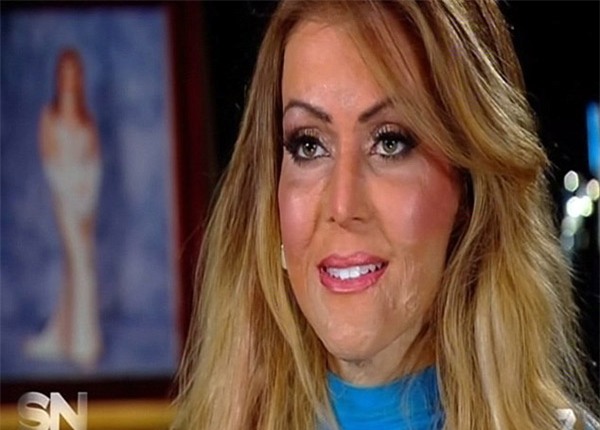 loi ke hai hung cua co gai bi nguoi la thieu song nhu ngon duoc vi... danh ghen nham - 4