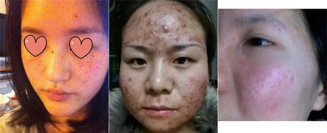 Cảnh báo: Mặt nạ giấy làm trắng giá rẻ có chứa huỳnh quang cực kì độc hại với sức khỏe - Ảnh 2.