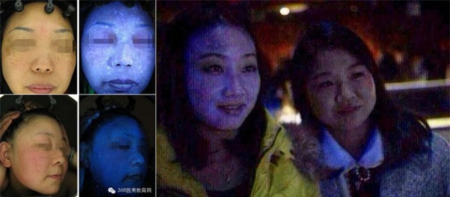Cảnh báo: Mặt nạ giấy làm trắng giá rẻ có chứa huỳnh quang cực kì độc hại với sức khỏe - Ảnh 3.