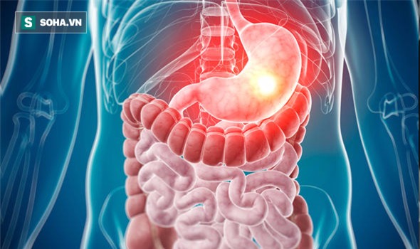 Mỡ tích ở vùng này có thể tăng nguy cơ 10 loại ung thư: Bạn có nguy cơ không? - Ảnh 2.