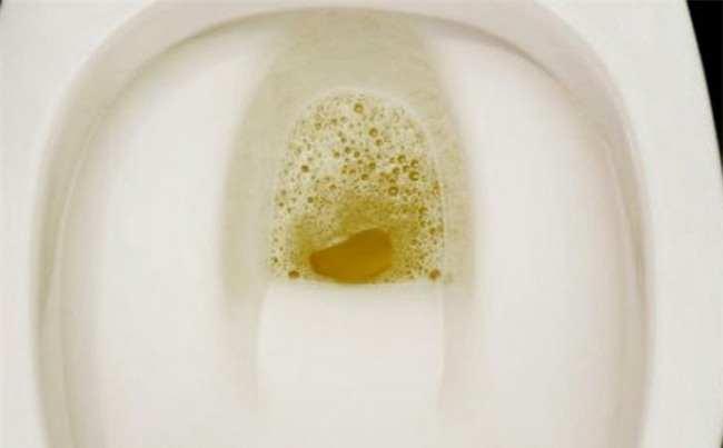 Nước tiểu có bọt: Dấu hiệu báo động không thể bỏ qua