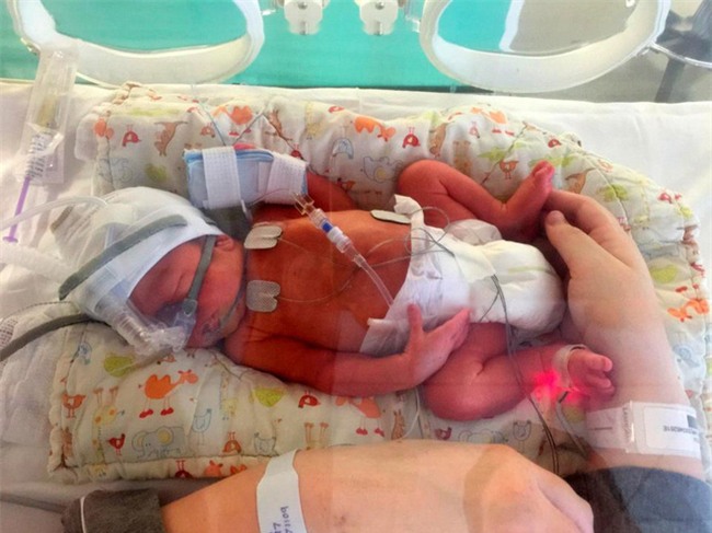 Để cậu bé này được ra đời, bố mẹ em đã phải đau lòng đánh đổi 2 mạng sống khác - Ảnh 3.
