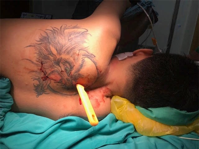 Cuu song nam thanh nien bi ban gai dam thung phoi hinh anh 1