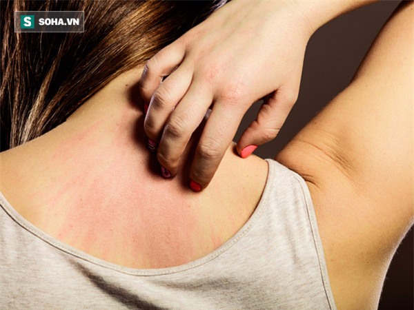 7 dấu hiệu cảnh báo ung thư mà 90% mọi người thường bỏ qua - Ảnh 1.