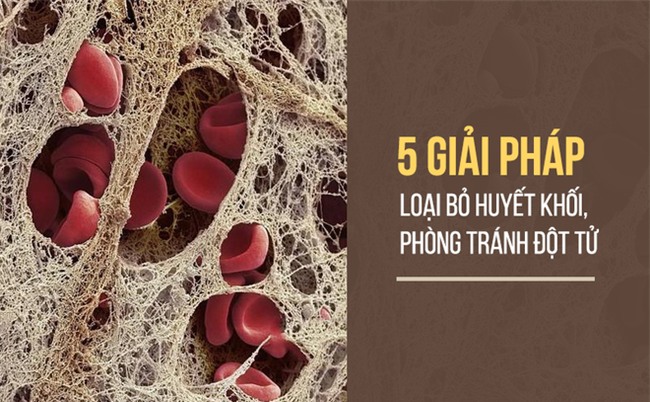 Bệnh tắc mạch máu dễ gây tử vong bất ngờ: 5 giải pháp này sẽ giúp bạn tự cứu mình