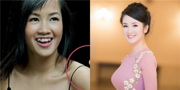 Fan tiếc nuối khi sao Việt “xóa sổ” răng khểnh làm mới hình ảnh - Tin sao Viet - Tin tuc sao Viet - Scandal sao Viet - Tin tuc cua Sao - Tin cua Sao