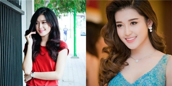 Sau khi làm răng, gương mặt Huyền My có nhiều sự thay đổi. - Tin sao Viet - Tin tuc sao Viet - Scandal sao Viet - Tin tuc cua Sao - Tin cua Sao