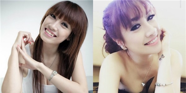 Hình ảnh Pha Lê sau khi “xóa sổ” chiếc răng khểnh đáng yêu. - Tin sao Viet - Tin tuc sao Viet - Scandal sao Viet - Tin tuc cua Sao - Tin cua Sao