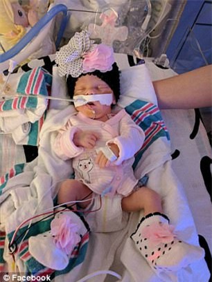 Tinh mang be so sinh bi de doa vi bac si khong xac dinh duoc benh hinh anh 1