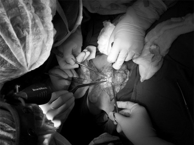 nam tren ban mo, me dau don thay 2 con gai song sinh chao doi chi co 1 cai mong - 3