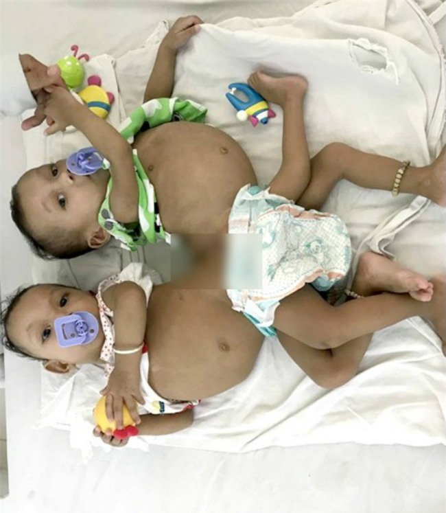 nam tren ban mo, me dau don thay 2 con gai song sinh chao doi chi co 1 cai mong - 4