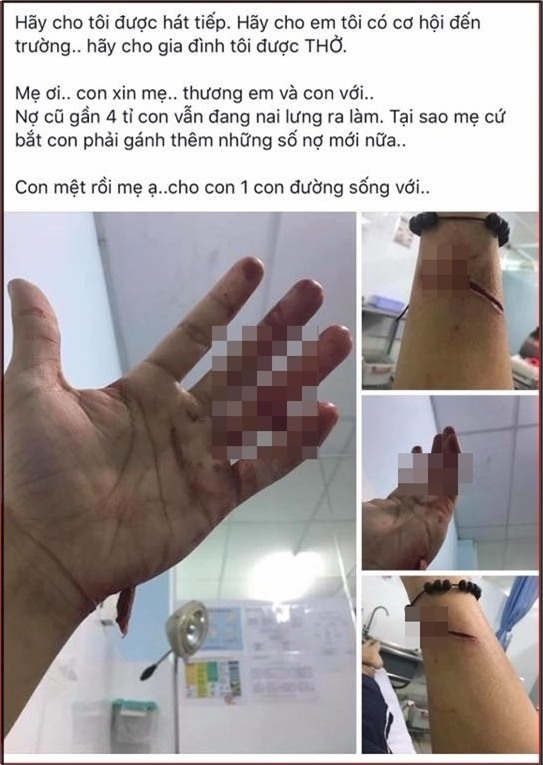 Dòng trạng thái và vết thương sau trận xô xát với gia đình của Đông Hùng khiến ai cũng phải xót xa. - Tin sao Viet - Tin tuc sao Viet - Scandal sao Viet - Tin tuc cua Sao - Tin cua Sao