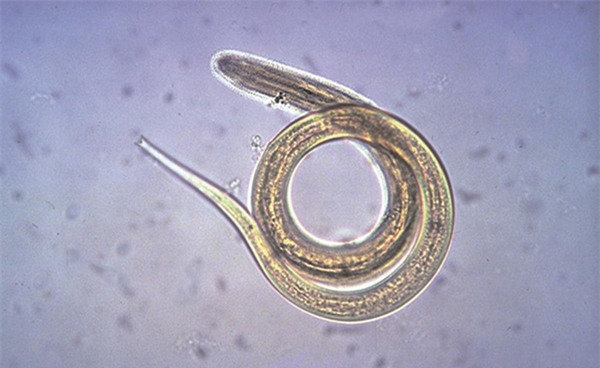 khiep so 10 can benh nguy hiem ban co the mac phai khi di tam - 7