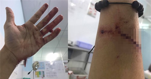 Dong Hung: '4 nam lam viec kiet suc de tra khoan no 16 ty dong cho me' hinh anh 1