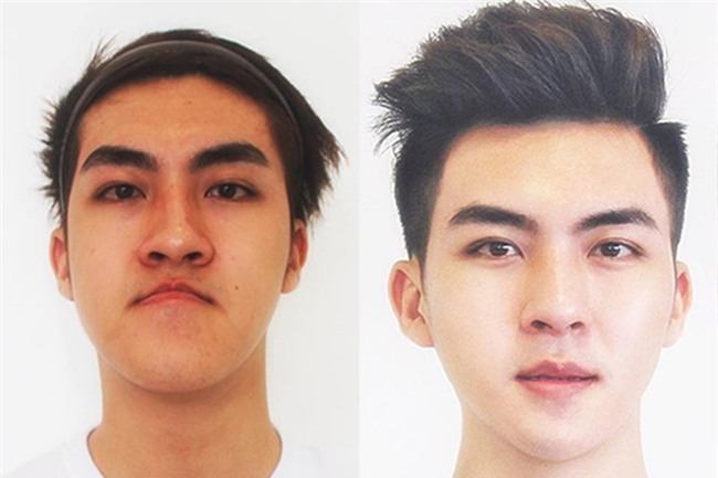 Sốc: Chàng trai Quảng Ninh mặt lưỡi liềm giờ đây đẹp như hotboy xứ Hàn-2